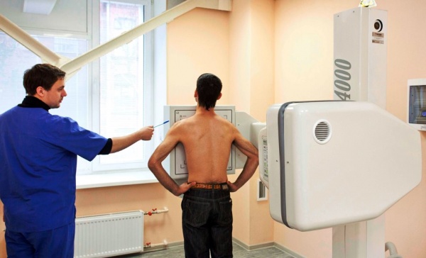 Флюорография процедура снятия